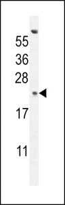 GAGE13 Antibody - GAGE13 Antibody western blot of K562 cell line lysates (35 ug/lane). The GAGE13 antibody detected the GAGE13 protein (arrow).