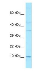 GAGE2A Antibody - GAGE2A antibody Western Blot of MDA-MB-435S cell lysate.  This image was taken for the unconjugated form of this product. Other forms have not been tested.