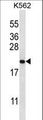 GAGE2B Antibody - GAGE2B Antibody western blot of K562 cell line lysates (35 ug/lane). The GAGE2B antibody detected the GAGE2B protein (arrow).