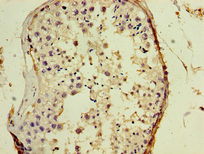 GAGE5 Antibody - Immunohistochemistry of paraffin-embedded human testis tissue using GAGE5 Antibody at dilution of 1:100