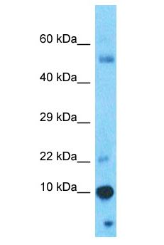 GAGEC1 / JM27 Antibody - GAGEC1 / JM27 antibody Western Blot of Thymus Tumor. Antibody dilution: 1 ug/ml.  This image was taken for the unconjugated form of this product. Other forms have not been tested.