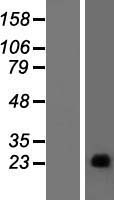 GAGEC1 / JM27 Protein - Western validation with an anti-DDK antibody * L: Control HEK293 lysate R: Over-expression lysate