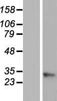 GAJ / MND1 Protein - Western validation with an anti-DDK antibody * L: Control HEK293 lysate R: Over-expression lysate