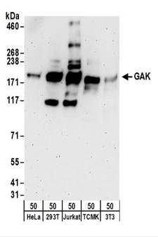 GAK Antibody - Detection of Human and Mouse GAK by Western Blot. Samples: Whole cell lysate (50 ug) from HeLa, 293T, Jurkat, mouse TCMK-1, and mouse NIH3T3 cells. Antibodies: Affinity purified rabbit anti-GAK antibody used for WB at 0.1 ug/ml. Detection: Chemiluminescence with an exposure time of 3 minutes.