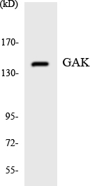 GAK Antibody - Western blot analysis of the lysates from HepG2 cells using GAK antibody.