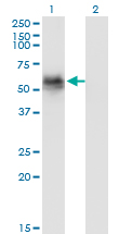 GAK Antibody - Western Blot analysis of GAK expression in transfected 293T cell line by GAK monoclonal antibody (M01), clone 4C10.Lane 1: GAK transfected lysate (Predicted MW: 44 KDa).Lane 2: Non-transfected lysate.