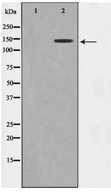 GAK Antibody - Western blot of 293 cell lysate using GAK Antibody