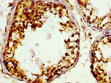 GAK Antibody - Immunohistochemistry image of paraffin-embedded human testis tissue at a dilution of 1:100
