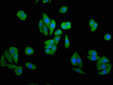 GAK Antibody - Immunofluorescence staining of HepG2 cells with GAK Antibody at 1:133, counter-stained with DAPI. The cells were fixed in 4% formaldehyde, permeabilized using 0.2% Triton X-100 and blocked in 10% normal Goat Serum. The cells were then incubated with the antibody overnight at 4°C. The secondary antibody was Alexa Fluor 488-congugated AffiniPure Goat Anti-Rabbit IgG(H+L).