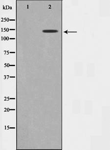 GAK Antibody - Western blot analysis on 293 cell lysates using GAK antibody. The lane on the left is treated with the antigen-specific peptide.