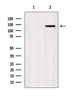 GAK Antibody - Western blot analysis of extracts of mouse brain tissue using GAK antibody. Lane 1 was treated with the blocking peptide.