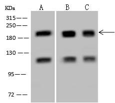 GAK Antibody - Anti-GAK rabbit polyclonal antibody at 1:500 dilution. Lane A: HeLa Whole Cell Lysate. Lane B: Jurkat Whole Cell Lysate. Lane C: U-251 MG Whole Cell Lysate. Lysates/proteins at 30 ug per lane. Secondary: Goat Anti-Rabbit IgG (H+L)/HRP at 1/10000 dilution. Developed using the ECL technique. Performed under reducing conditions. Predicted band size: 143 kDa.