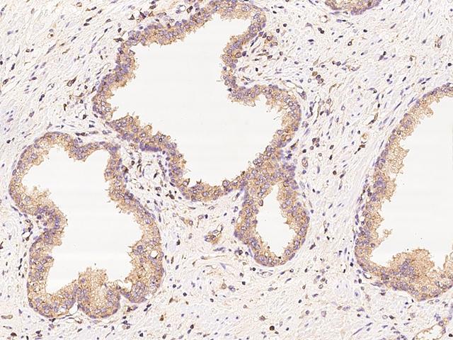 GAK Antibody - Immunochemical staining of human GAK in human prostate with rabbit polyclonal antibody at 1:100 dilution, formalin-fixed paraffin embedded sections.