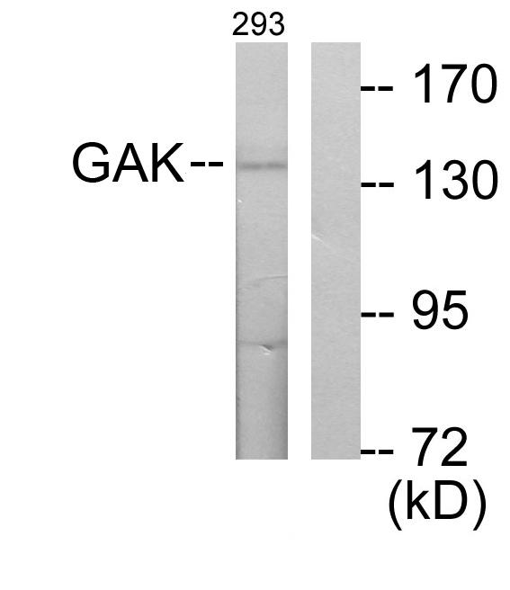 GAK Antibody - Western blot analysis of extracts from 293 cells, using GAK antibody.