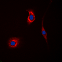 GAK Antibody - Immunofluorescent analysis of GAK staining in HeLa cells. Formalin-fixed cells were permeabilized with 0.1% Triton X-100 in TBS for 5-10 minutes and blocked with 3% BSA-PBS for 30 minutes at room temperature. Cells were probed with the primary antibody in 3% BSA-PBS and incubated overnight at 4 deg C in a humidified chamber. Cells were washed with PBST and incubated with a DyLight 594-conjugated secondary antibody (red) in PBS at room temperature in the dark. DAPI was used to stain the cell nuclei (blue).
