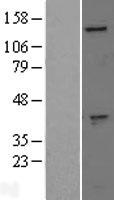 GAK Protein - Western validation with an anti-DDK antibody * L: Control HEK293 lysate R: Over-expression lysate