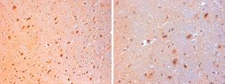 GAL / Galanin Antibody - Anti-Mouse Galanin staining (4 µg/ml) of a mouse brain formalin-fixed, paraffin-embedded tissue section; seen at 20x (left) and 40x (right) magnification. Staining of cytoplasmic extensions of glial cells is observed.