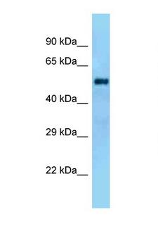 GAL3ST4 Antibody - GAL3ST4 antibody Western blot of Rat Liver lysate. Antibody concentration 1 ug/ml.  This image was taken for the unconjugated form of this product. Other forms have not been tested.