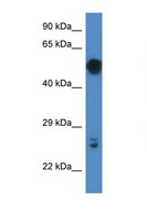 GAL3ST4 Antibody - GAL3ST4 antibody Western blot of Mouse Pancreas lysate. Antibody concentration 1 ug/ml.  This image was taken for the unconjugated form of this product. Other forms have not been tested.