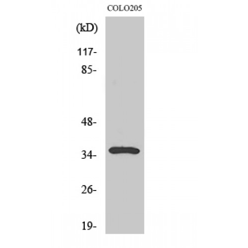 GAL4 / Galectin 4 Antibody - Western blot of Galectin-4 antibody