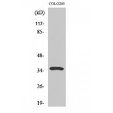 GAL4 / Galectin 4 Antibody - Western blot of Galectin-4 antibody