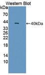 GAL4 / Galectin 4 Antibody - Western blot of GAL4 / Galectin 4 antibody.