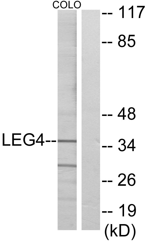 GAL4 / Galectin 4 Antibody - Western blot analysis of lysates from COLO cells, using LEG4 Antibody. The lane on the right is blocked with the synthesized peptide.