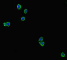 GAL4 / Galectin 4 Antibody - Immunofluorescent analysis of HepG2 cells diluted at 1:100 and Alexa Fluor 488-congugated AffiniPure Goat Anti-Rabbit IgG(H+L)
