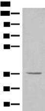 GAL4 / Galectin 4 Antibody - Western blot analysis of HT-29 cell lysate  using LGALS4 Polyclonal Antibody at dilution of 1:300