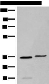 GAL4 / Galectin 4 Antibody - Western blot analysis of Human sigmoid tissue and HT-29 cell lysates  using LGALS4 Polyclonal Antibody at dilution of 1:400