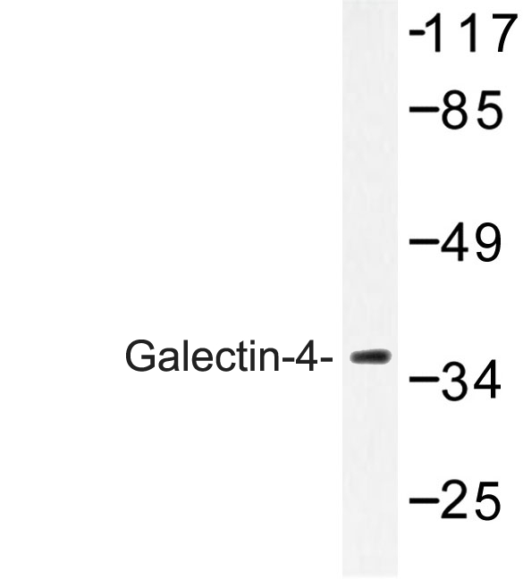 GAL4 / Galectin 4 Antibody - Western blot of Galectin-4 (K83) pAb in extracts from COLO cells.