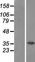 GAL4 / Galectin 4 Protein - Western validation with an anti-DDK antibody * L: Control HEK293 lysate R: Over-expression lysate