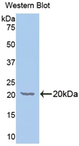 GALC / Galactocerebrosidase Antibody - Western Blot; Sample: Recombinant protein.