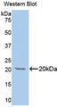 GALC / Galactocerebrosidase Antibody - Western Blot; Sample: Recombinant protein.