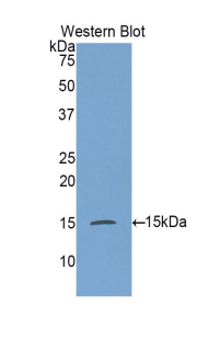 GALC / Galactocerebrosidase Antibody - Western blot of recombinant GALC / Galactocerebrosidase.  This image was taken for the unconjugated form of this product. Other forms have not been tested.