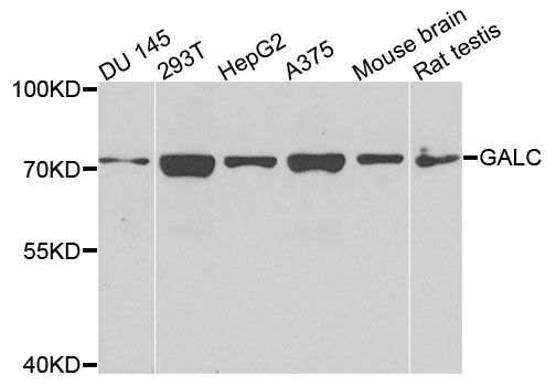 GALC / Galactocerebrosidase Antibody - Western blot analysis of extracts of various cells.