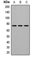 GALC / Galactocerebrosidase Antibody - Western blot analysis of GALC expression in HepG2 (A), mouse brain (B), rat testis (C) whole cell lysate