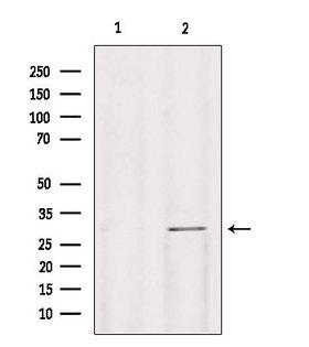 GALC / Galactocerebrosidase Antibody - Western blot analysis of extracts of mouse lung using Galc antibody. Lane 1 was treated with the blocking peptide.