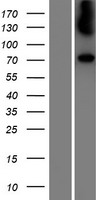 GALC / Galactocerebrosidase Protein - Western validation with an anti-DDK antibody * L: Control HEK293 lysate R: Over-expression lysate