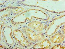 GALE / UDP-Glucose 4-Epimerase Antibody - Immunohistochemistry of paraffin-embedded human kidney using antibody at 1:100 dilution.  This image was taken for the unconjugated form of this product. Other forms have not been tested.