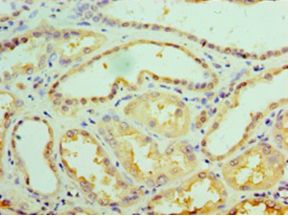 GALE / UDP-Glucose 4-Epimerase Antibody - Immunohistochemistry of paraffin-embedded human kidney using antibody at 1:100 dilution.  This image was taken for the unconjugated form of this product. Other forms have not been tested.