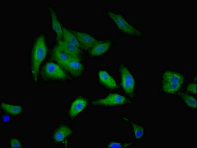 GALE / UDP-Glucose 4-Epimerase Antibody - Immunofluorescent analysis of Hela cells using GALE Antibody at dilution of 1:100 and Alexa Fluor 488-congugated AffiniPure Goat Anti-Rabbit IgG(H+L)