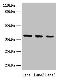 GALE / UDP-Glucose 4-Epimerase Antibody - Western blot All lanes: UDP-glucose 4-epimerase antibody at 2µg/ml Lane 1: HepG2 cells Lane 2: Hela cells Lane 3: A549 cells Secondary Goat polyclonal to rabbit IgG at 1/10000 dilution Predicted band size: 39, 31 kDa Observed band size: 39 kDa