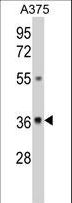 GALE / UDP-Glucose 4-Epimerase Antibody - Western blot of GALE Antibody in A375 cell line lysates (35 ug/lane). GALE (arrow) was detected using the purified antibody.