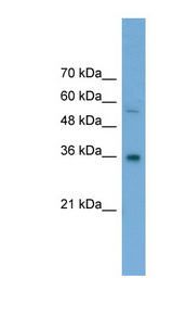 GALE / UDP-Glucose 4-Epimerase Antibody - GALE antibody Western blot of Transfected 293T cell lysate. This image was taken for the unconjugated form of this product. Other forms have not been tested.