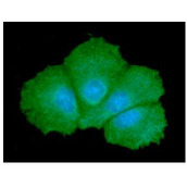 GALE / UDP-Glucose 4-Epimerase Antibody - ICC/IF analysis of GALE in Hep3B cells line, stained with DAPI (Blue) for nucleus staining and monoclonal anti-human GALE antibody (1:100) with goat anti-mouse IgG-Alexa fluor 488 conjugate (Green).