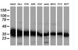 GALE / UDP-Glucose 4-Epimerase Antibody - Western blot of extracts (35 ug) from 9 different cell lines by using anti-GALE monoclonal antibody (HepG2: human; HeLa: human; SVT2: mouse; A549: human; COS7: monkey; Jurkat: human; MDCK: canine; PC12: rat; MCF7: human).