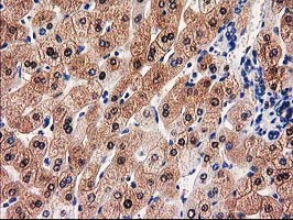 GALE / UDP-Glucose 4-Epimerase Antibody - IHC of paraffin-embedded Human liver tissue using anti-GALE mouse monoclonal antibody.