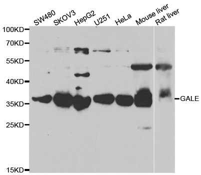 GALE / UDP-Glucose 4-Epimerase Antibody - Western blot analysis of extracts of various cell lines.