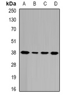 GALE / UDP-Glucose 4-Epimerase Antibody - Western blot analysis of GALE expression in HepG2 (A); HeLa (B); mouse liver (C); rat liver (D) whole cell lysates.